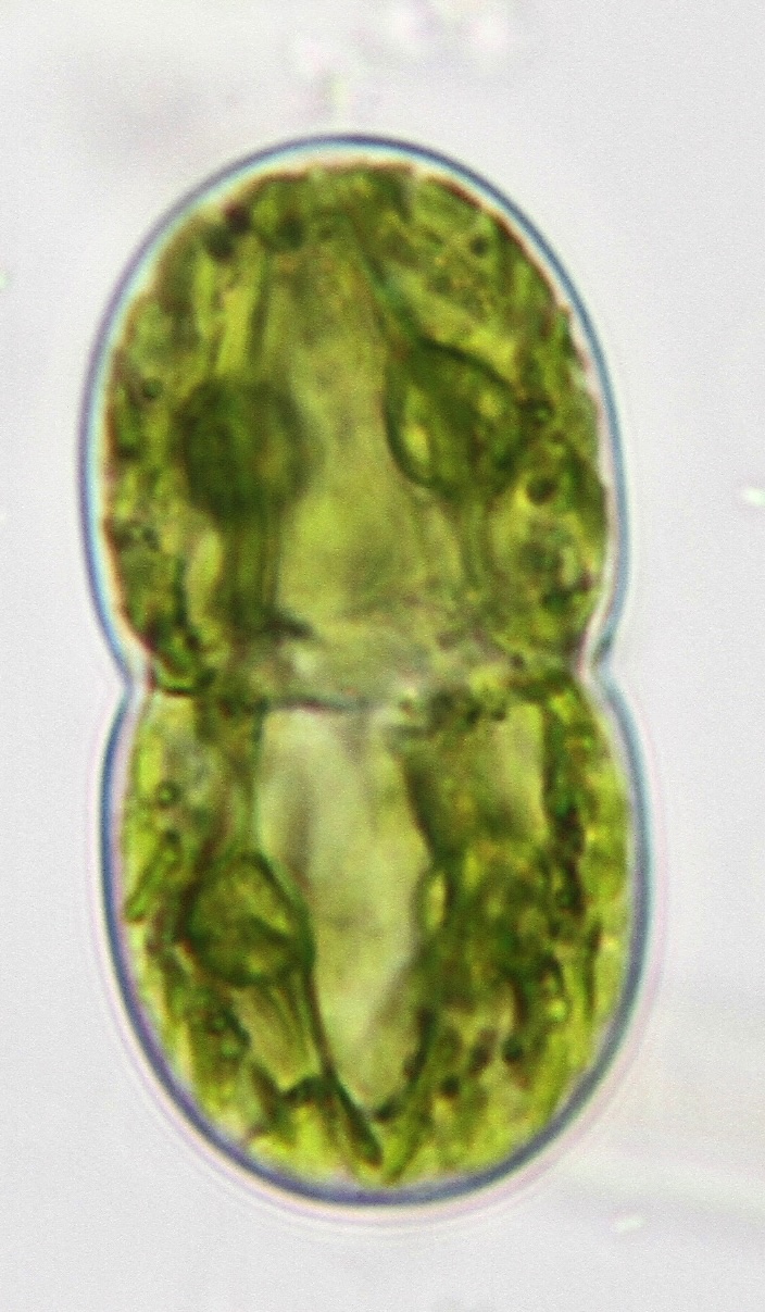 Cosmarium thwaitesii